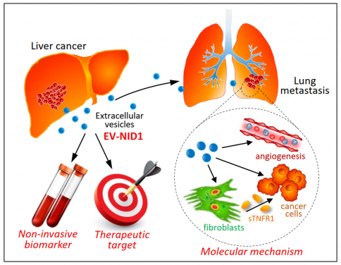 香港大學李嘉誠醫學院（港大醫學院）研究團隊發現，肝癌細胞來源的胞外囊泡（EVs）加促了腫瘤的生長和向肺部轉移。這項嶄新發現為肝癌治療提供了新的生物指標及治療方向。
 