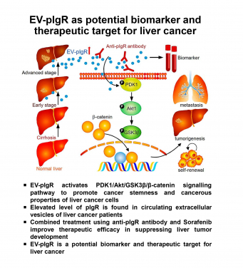 HKUMed researchers identified a key molecule in extracellular vesicles of liver cancer patient as a potential new biomarker 
for early diagnosis and therapeutic target
 